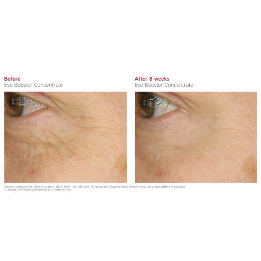 Intense Stem Cell Eye Booster Concentrate