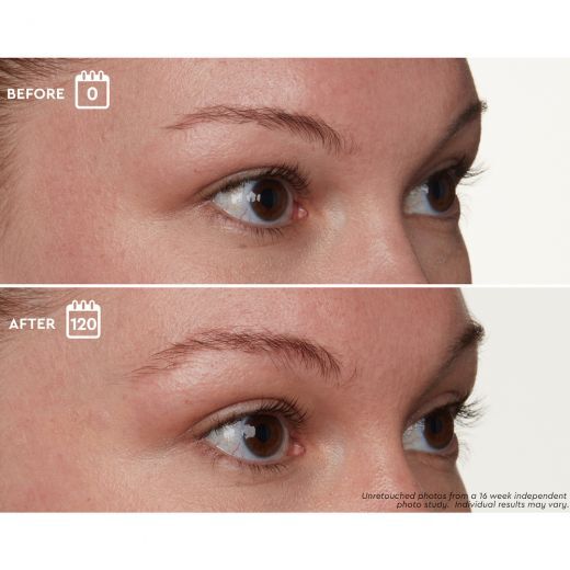 Brow Genius® Serum