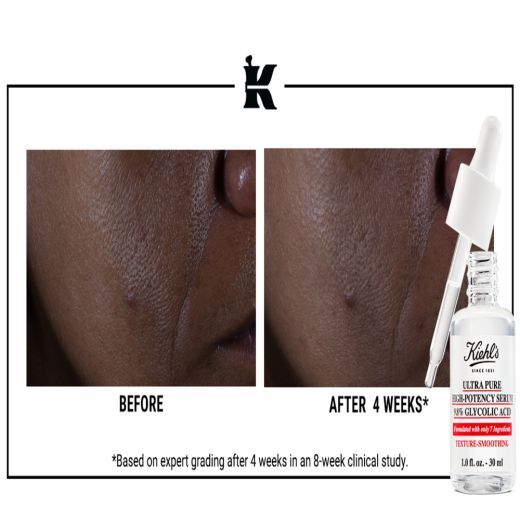 Kiehl's Ultra Pure High-Potency Serum 9.8% Glycolic Acid, 30 ml