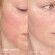 Cool Biotic™ Prebiotic Redness Relief Cream