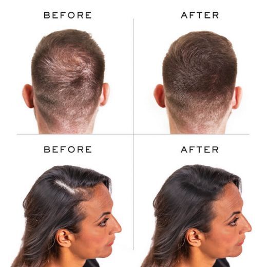 NANOGEN Keratin Hair Fibres Plaukų efektą sukurianti pudra-skaidulos